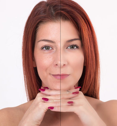 Blog Feed Article Feature Image Carousel: How can I restore collagen in my face? 