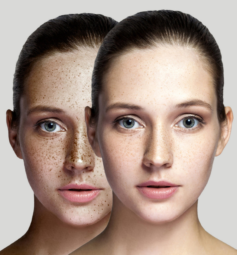 Green Tea Benefits for Repairing Sun Damage Green Tea Benefits for Repairing Sun Damage