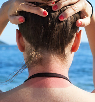  Top Areas We Forget to Apply Sunscreen