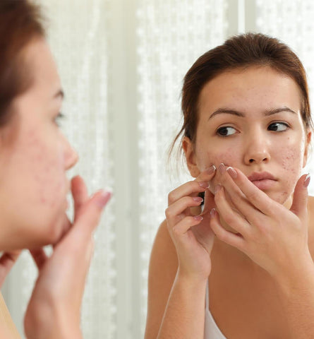 Blog Feed Article Feature Image Carousel: 8 Ingredients That Can Fade Acne Scars 