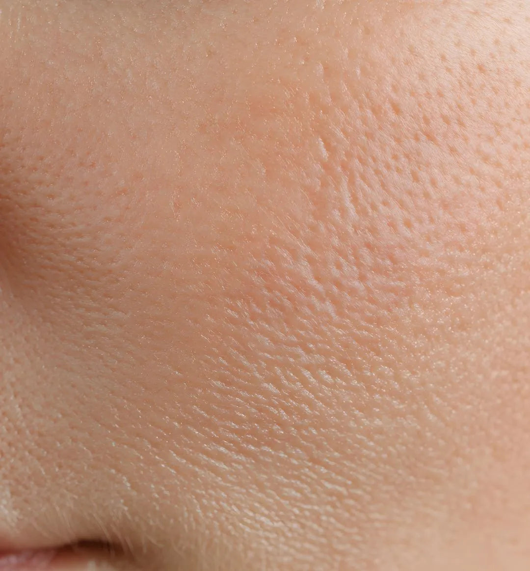 How to Smooth & Rebalance Skin After Routine Disrup – 100% PURE