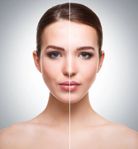 Blog Feed Article Feature Image Carousel: The Transformation Within: Your Skin Reset Before & After 