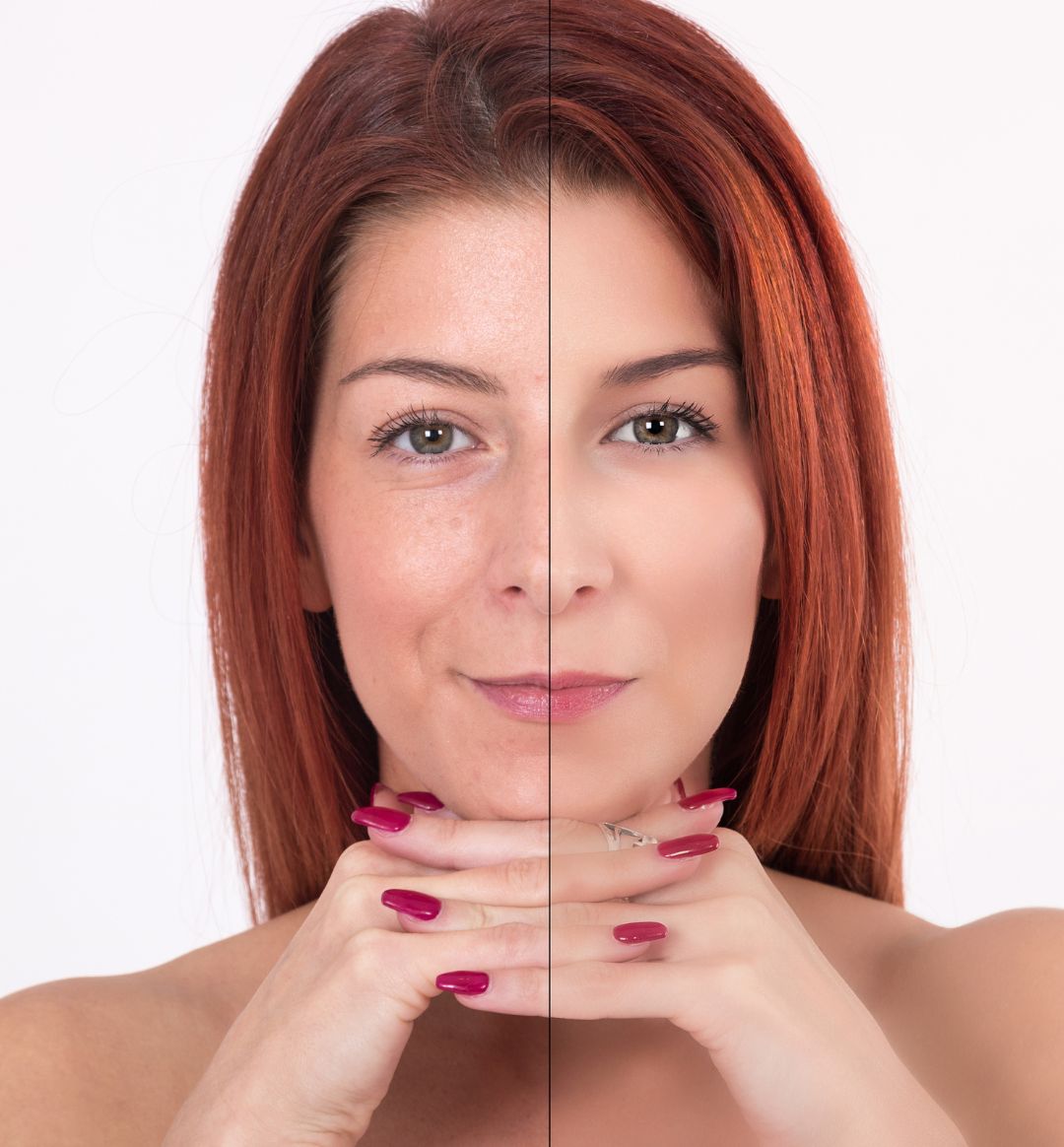 How can I restore collagen in my face? – 100% PURE How can I restore collagen in my face? – 100% PURE