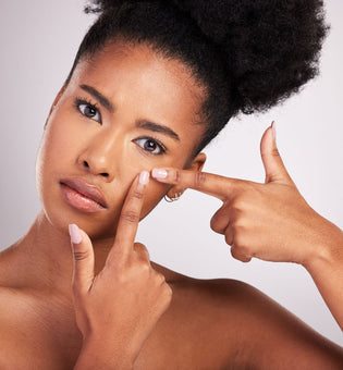  How to Get Rid of Blackheads: Expert-Approved Tips for Clearer Skin
