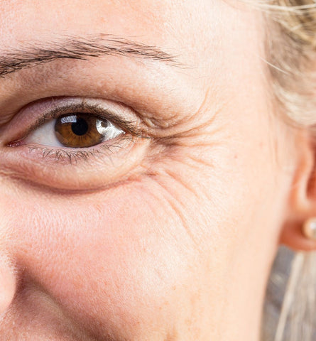 Blog Feed Article Feature Image Carousel: Say Goodbye to Crow's Feet: Effective Tips for Smoother Eyes 