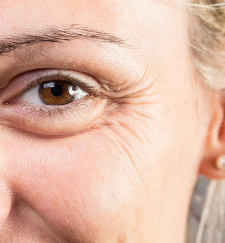 Blog Feed Article Feature Image Carousel: Say Goodbye to Crow's Feet: Effective Tips for Smoother Eyes 
