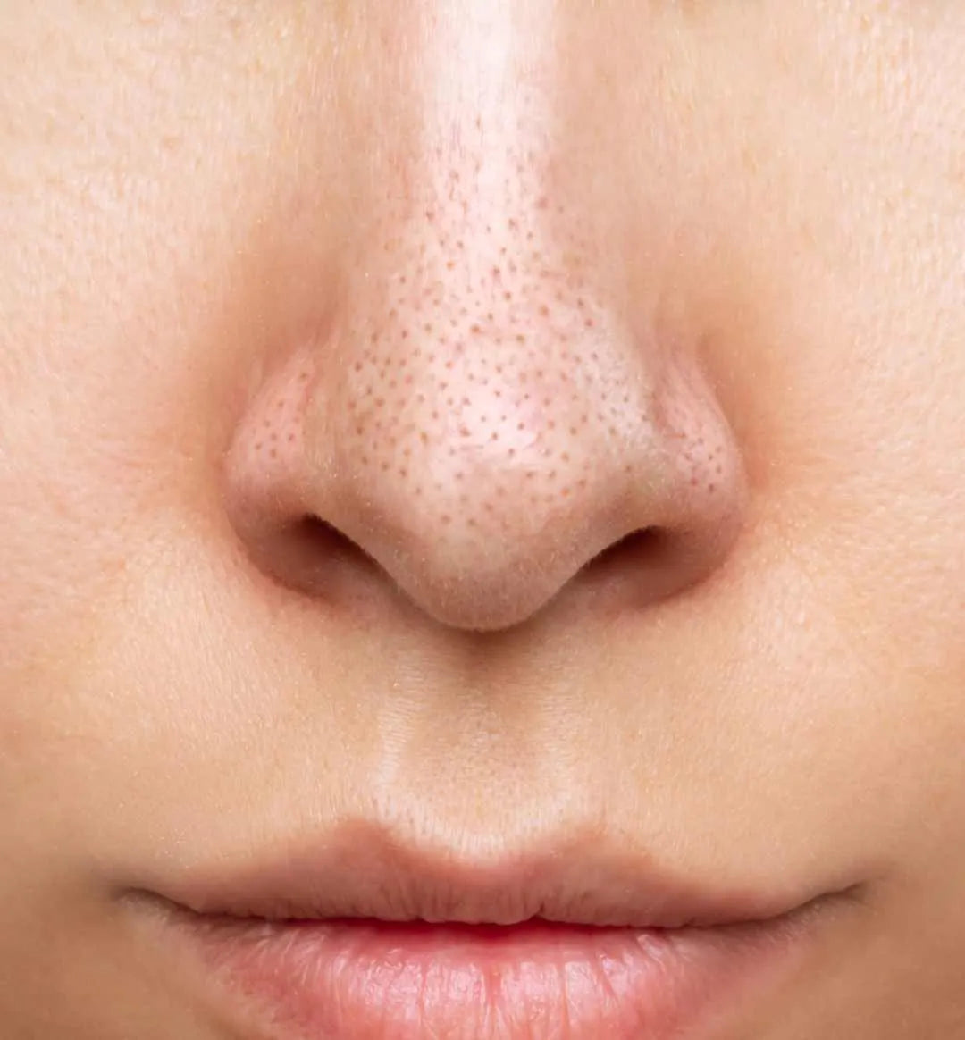 How to Make Pores Small: A Comprehensive Guide