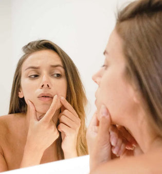 Sebaceous Filaments vs Blackheads: What’s the Difference and How to Treat Them