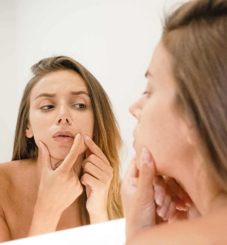 Blog Feed Article Feature Image Carousel: Sebaceous Filaments vs Blackheads: What’s the Difference and How to Treat Them 