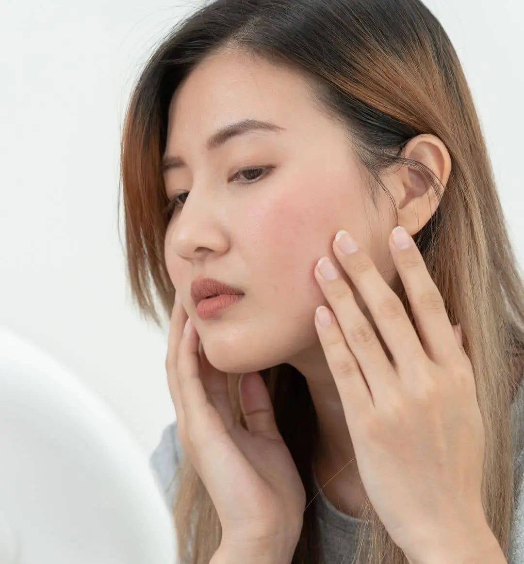 Sensitive Skin SOS: Soothing Solutions for Irritated Skin