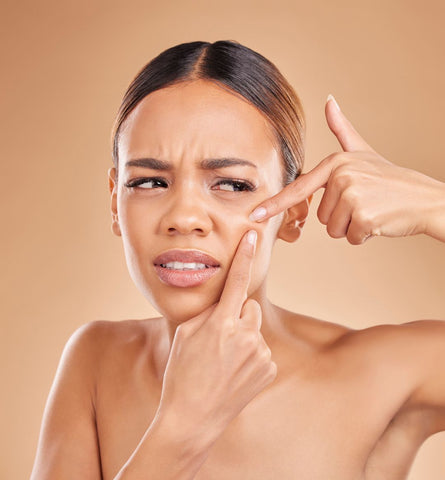 Blog Feed Article Feature Image Carousel: Unmasking the Truth: Are Blackheads a Sign of Ineffective Cleansing? 