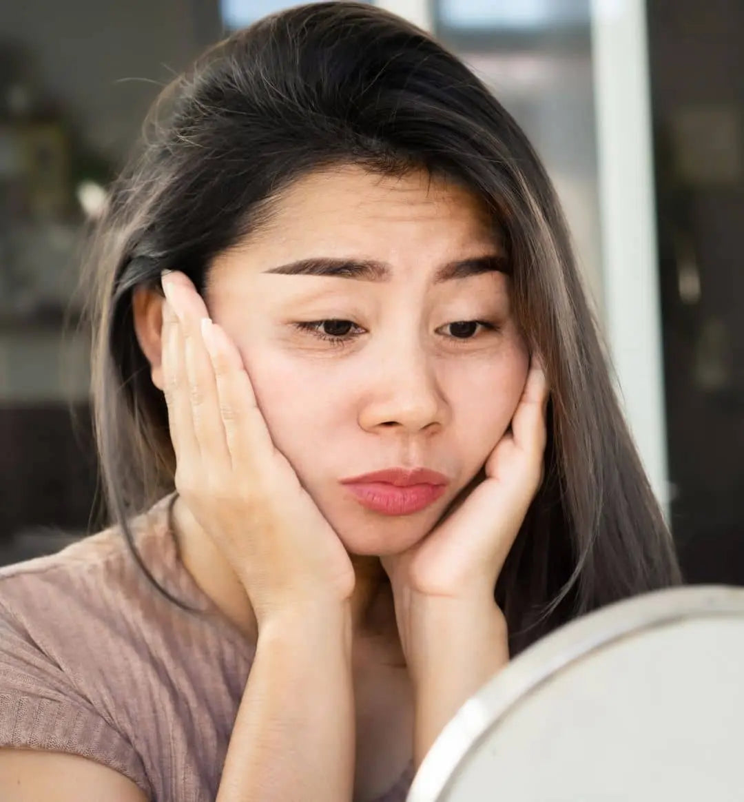 Dark Under Eye Circles: Discover Your Type Today!