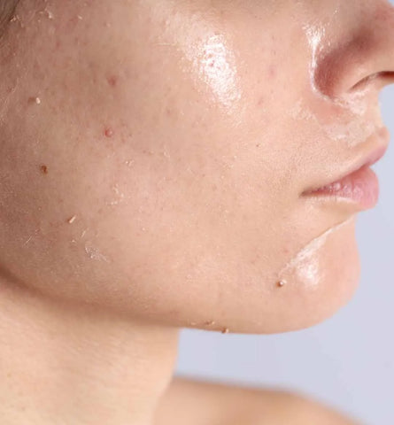 Blog Feed Article Feature Image Carousel: Why Your Skin Does Not Respond Well to Trends 