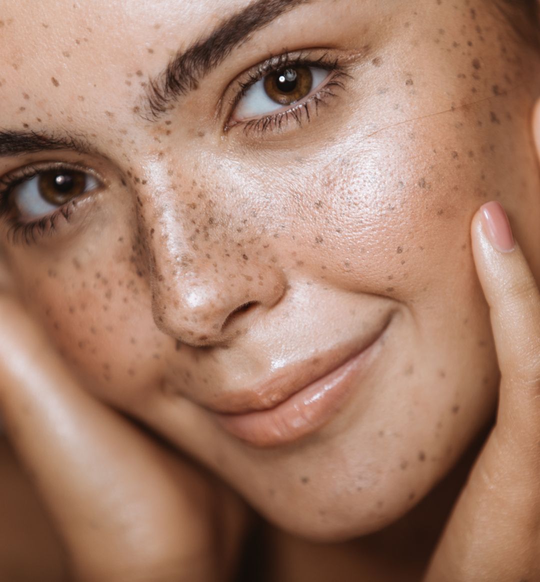 What does Lactic Acid Do For Skin? 100 PURE