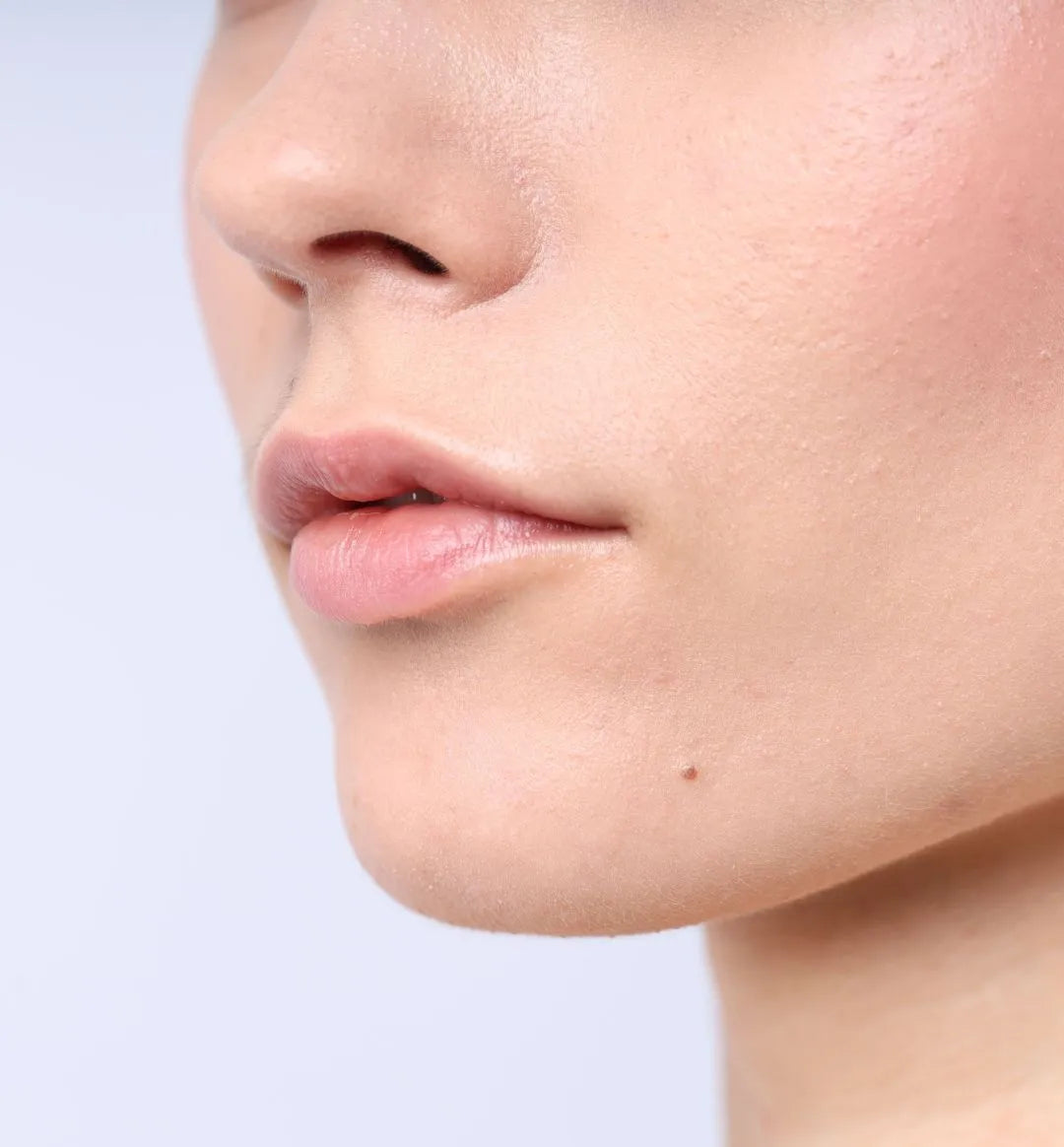 3 Issues Making Your Pores and skin Delicate – 100% PURE
