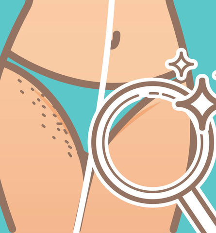 Blog Feed Article Feature Image Carousel: How to Get Rid of Ingrown Hair in 5 Steps 