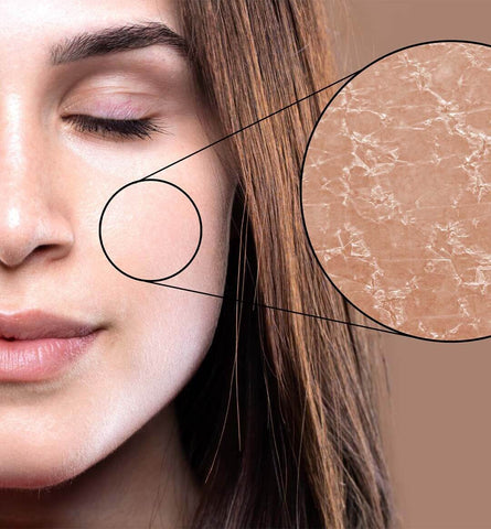 Blog Feed Article Feature Image Carousel: How to Tell If You Have Dry Skin 