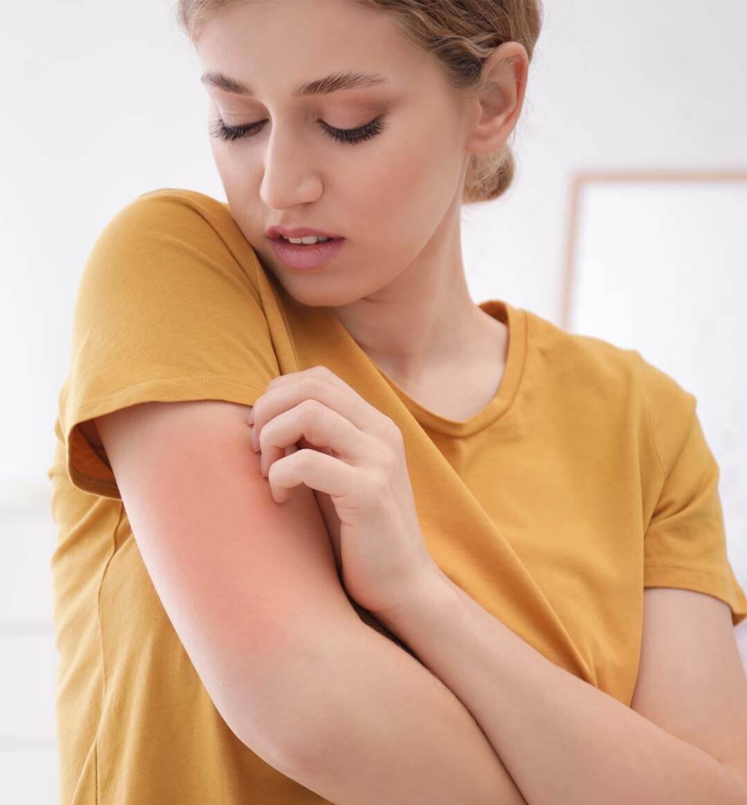 Clean Ingredients for Eczema Relief: Top 10 Picks Clean Ingredients for Eczema Relief: Top 10 Picks