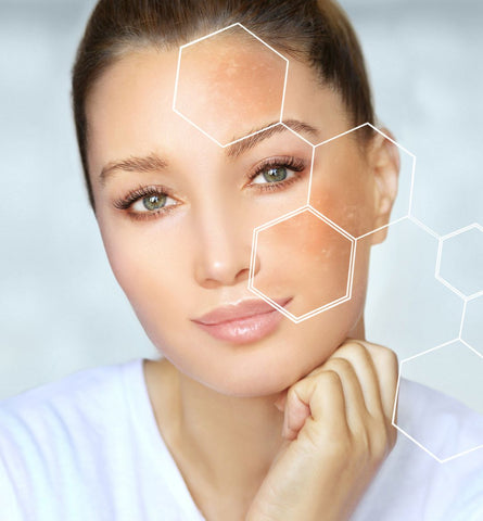 Blog Feed Article Feature Image Carousel: How To Repair Your Skin Barrier 
