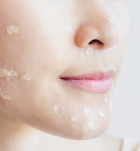 Blog Feed Article Feature Image Carousel: How To Cover Pimples & Acne With Makeup 
