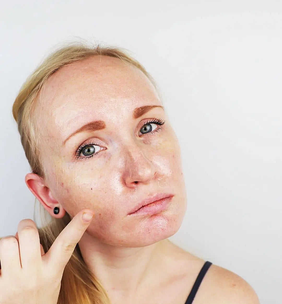 100% Puro - Chicas con piel grasa