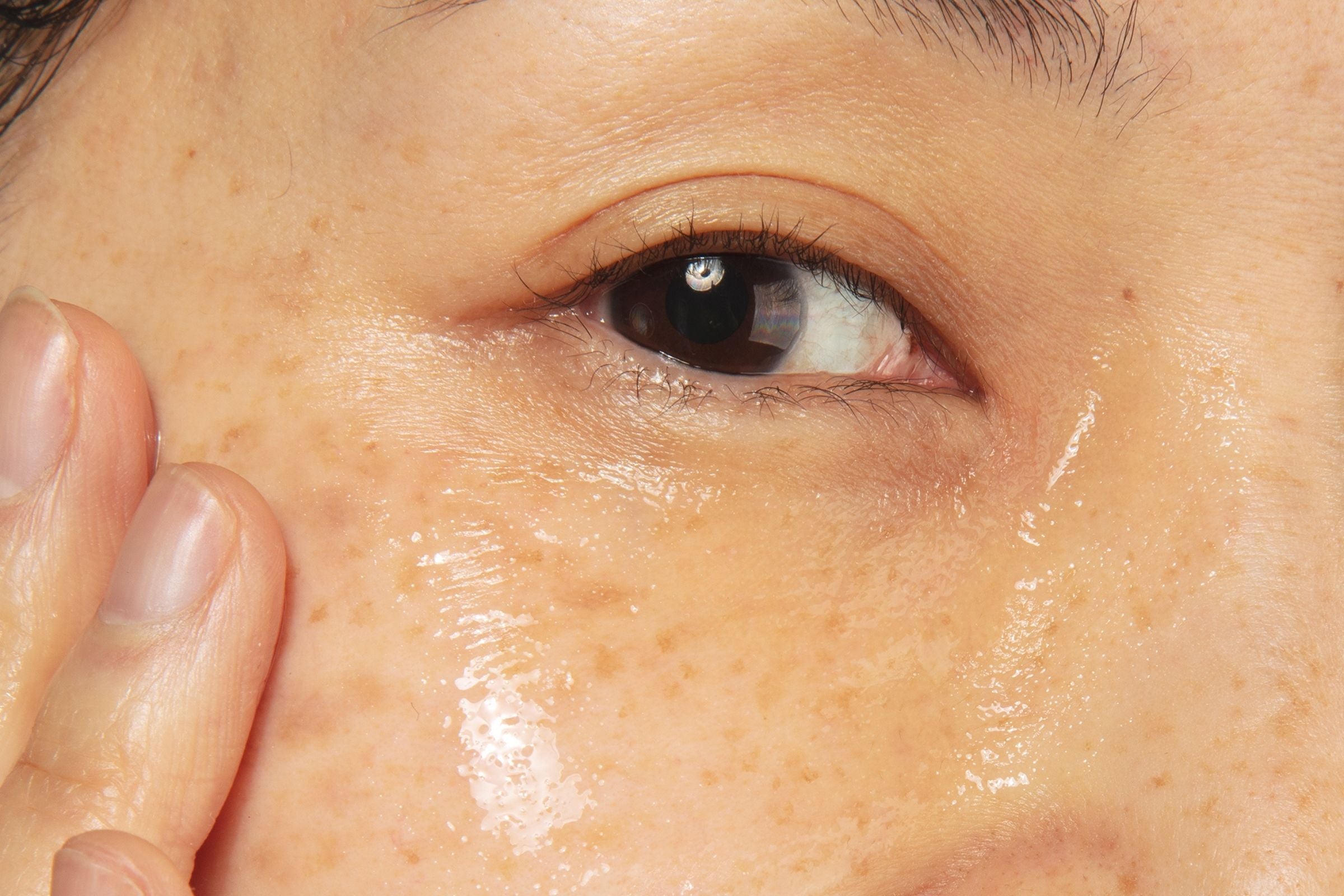 Woman using hyaluronic acid on her face