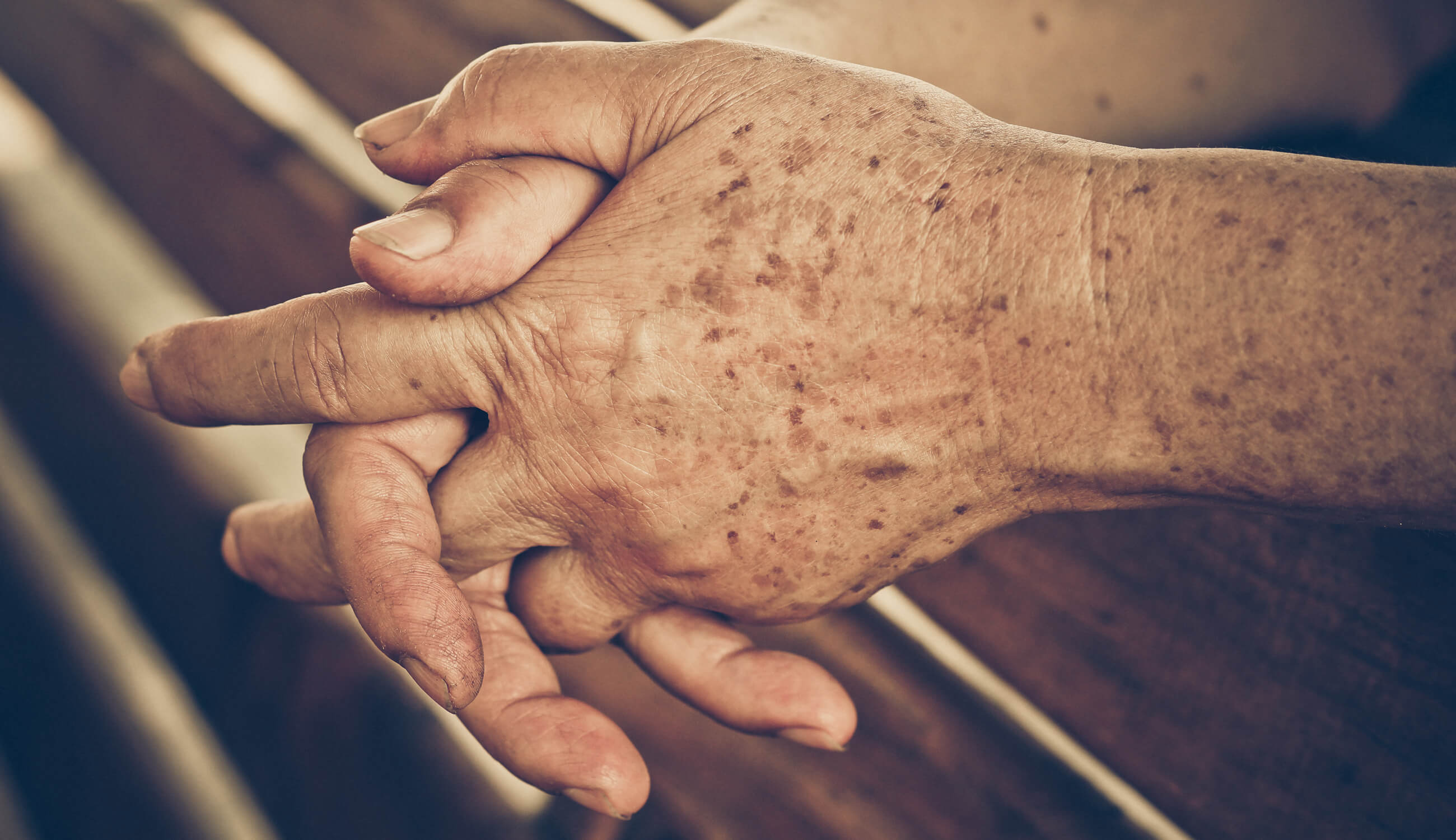 aging hands