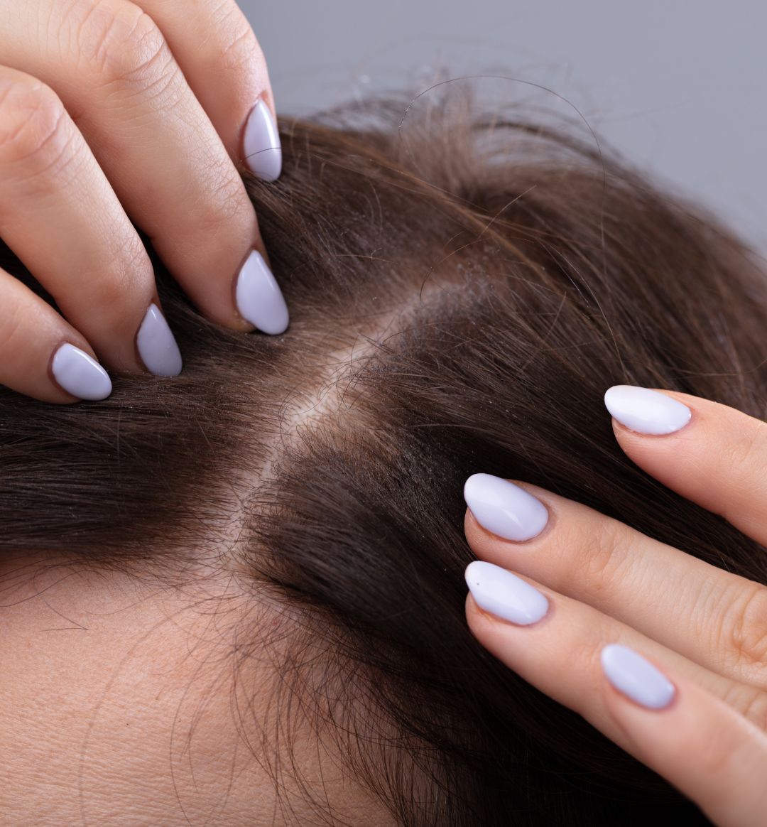 Close_up_shot_of_woman_s_scalp