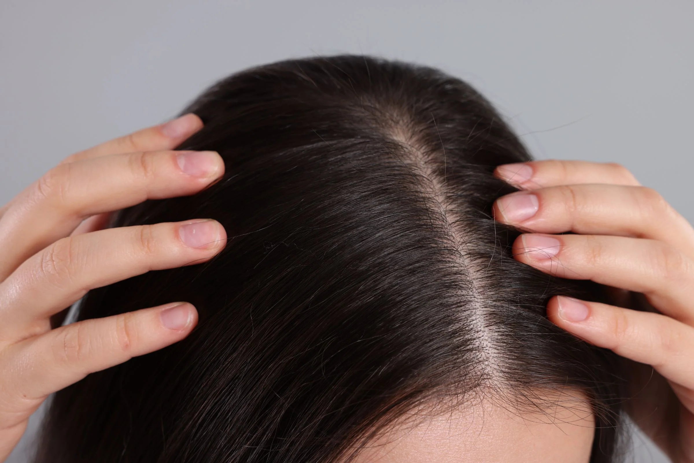Cover_Photo_-_100_Pure_Scalp_Folliculitis_Could_Be_Behind_Your_Itching_and_Hair_Loss