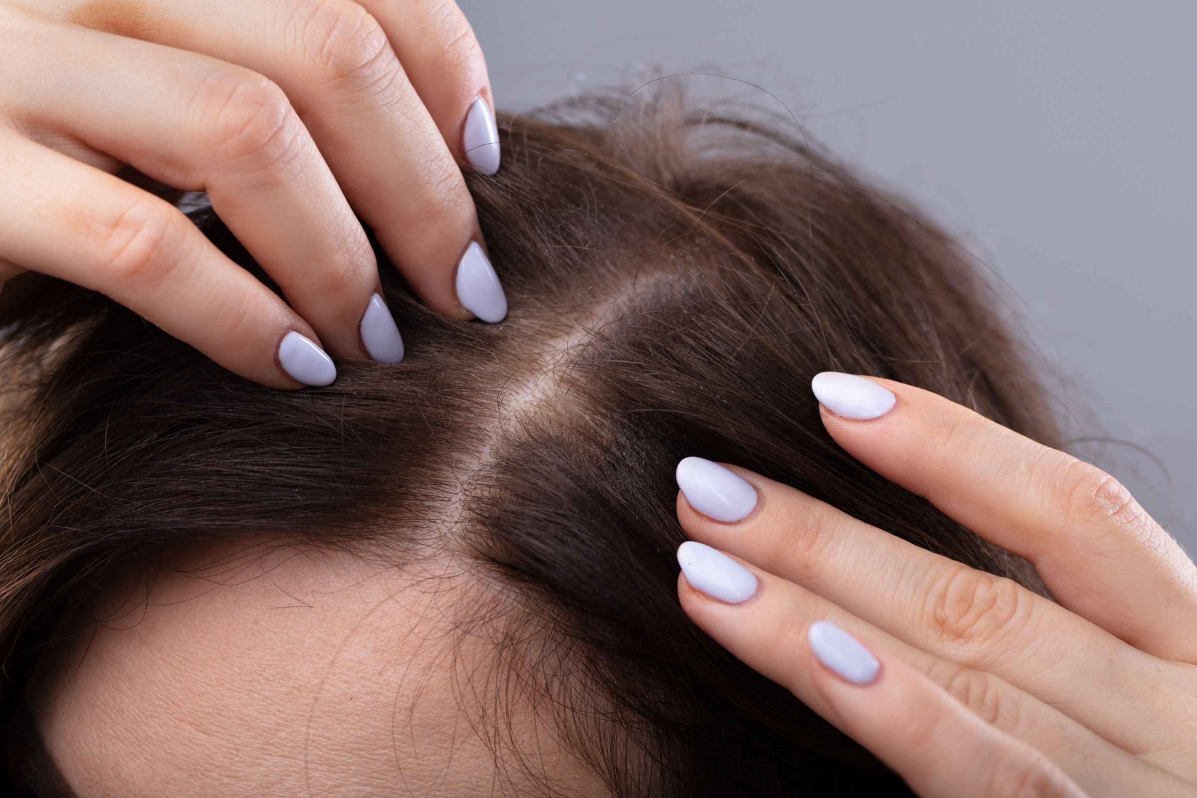 Cover_Photo_-_100__Pure_The_Potential_of_Rosemary_Oil_for_Treating_Hair_Loss_and_Baldness