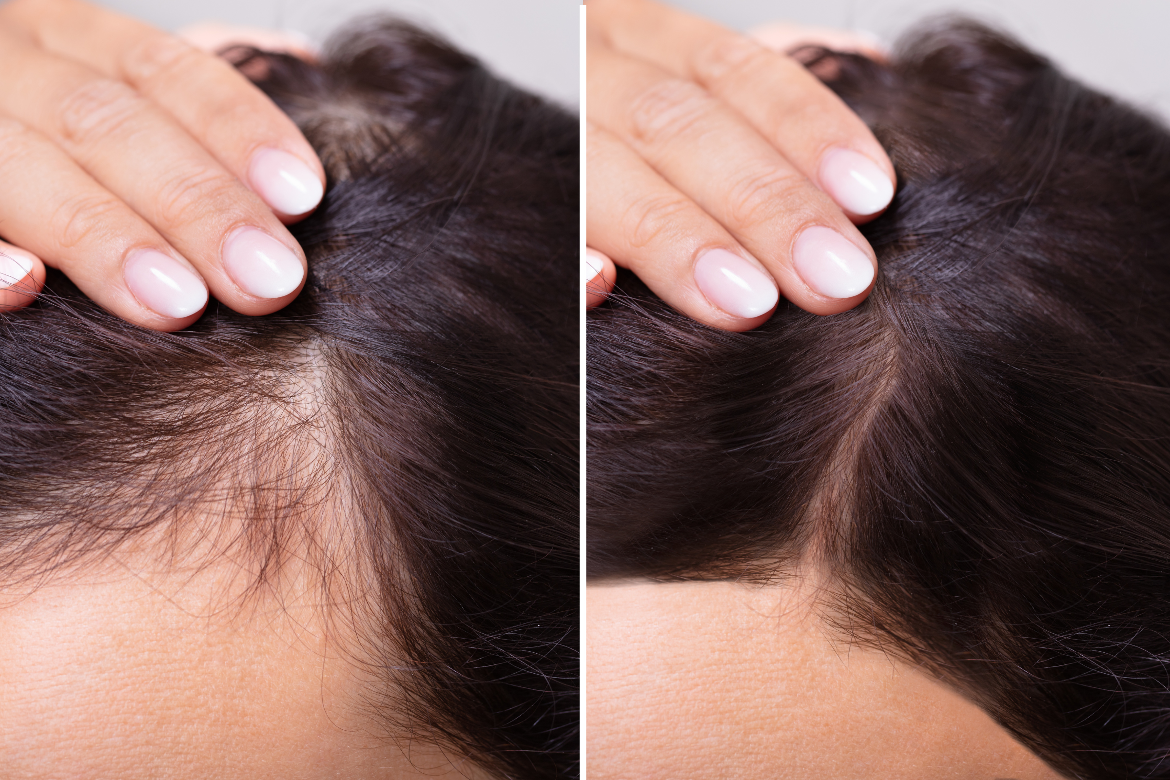 Cover_Photo_100_PURE_Natural_Solutions_for_Hair_Loss__Your_Complete_Guide_to_Regrowth