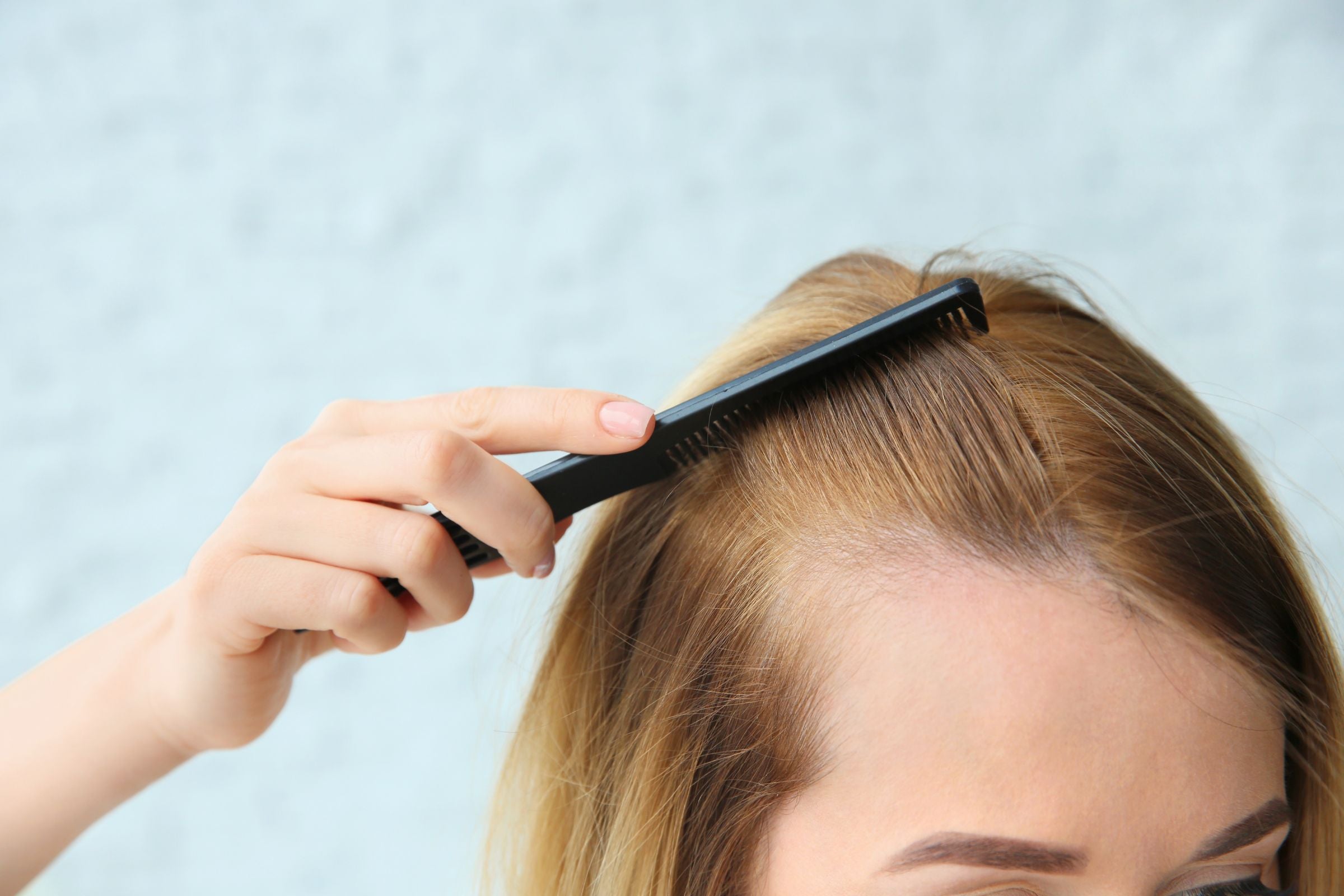 Cover_Photo_100_PURE_Rosemary_vs._Minoxidil__Natural_Hair_Loss_Solutions