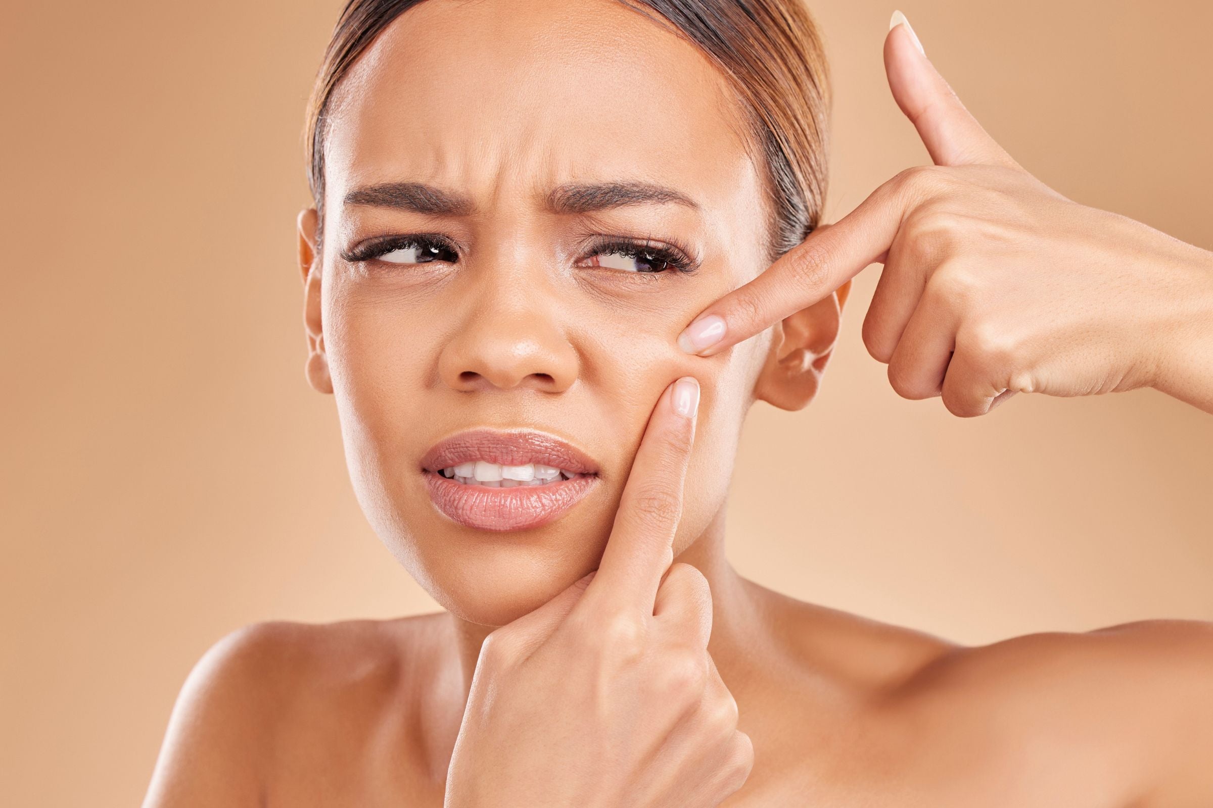 Cover_Photo_100_PURE_Unmasking_the_Truth__Are_Blackheads_a_Sign_of_Ineffective_Cleansing