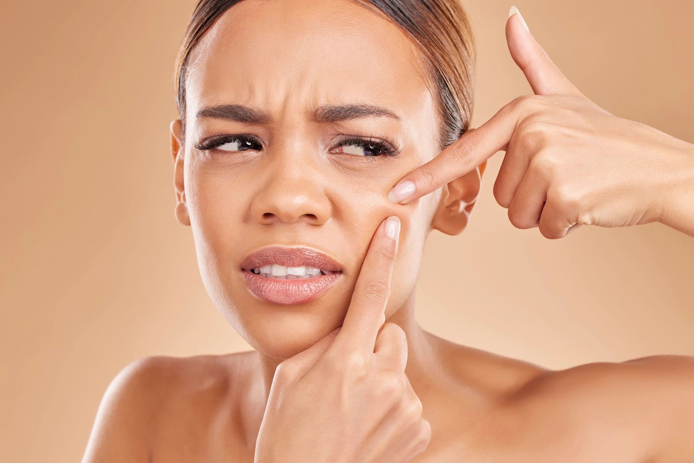 Cover_Photo_100_PURE_Unmasking_the_Truth__Are_Blackheads_a_Sign_of_Ineffective_Cleansing