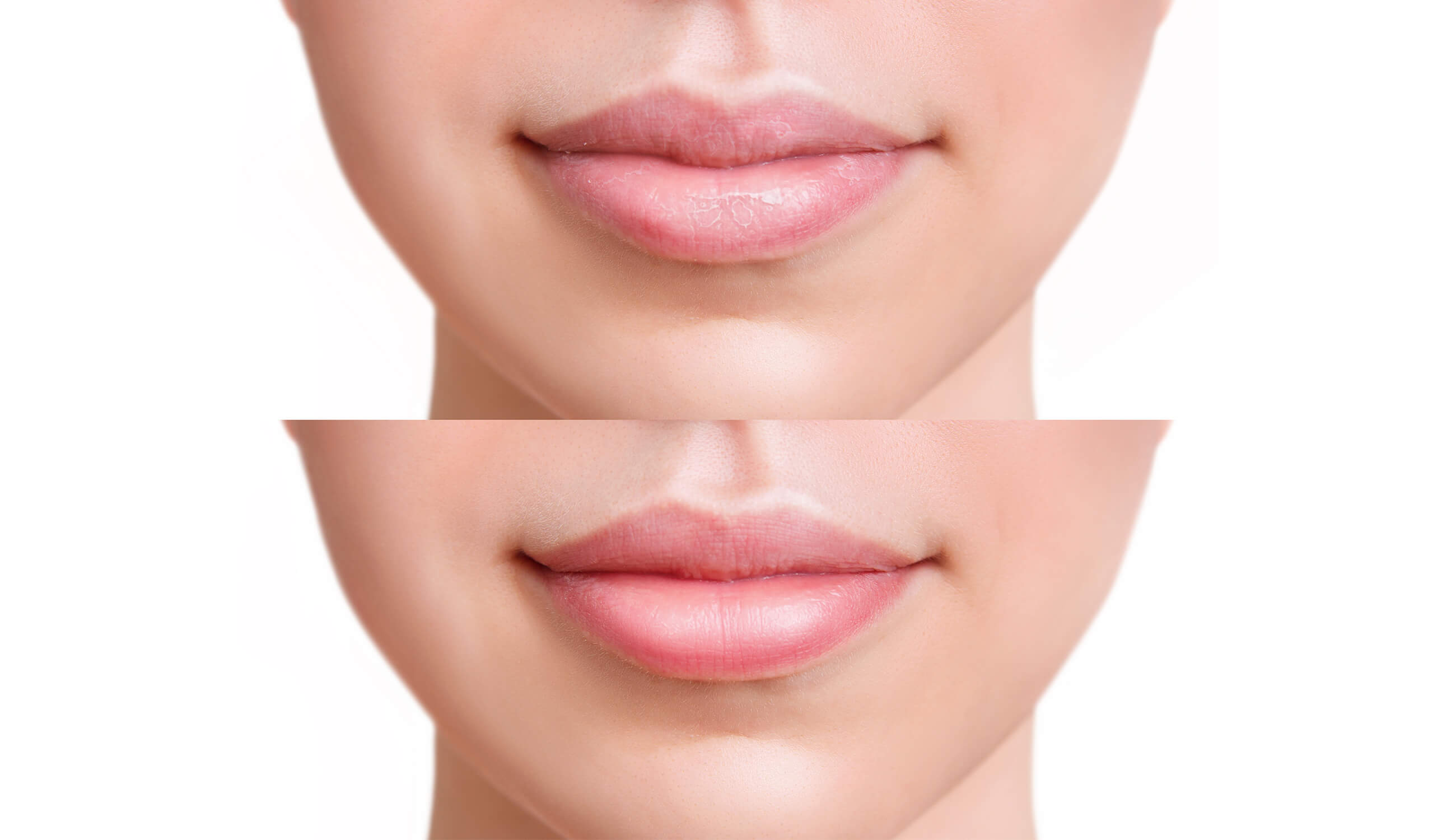 Before after of using lip scrub