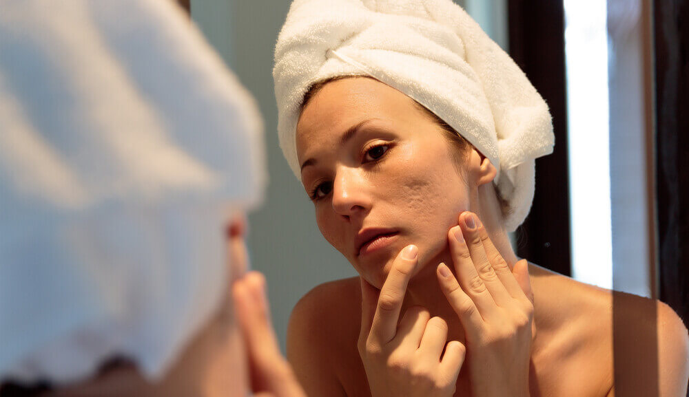 Woman inspecting her facial scars